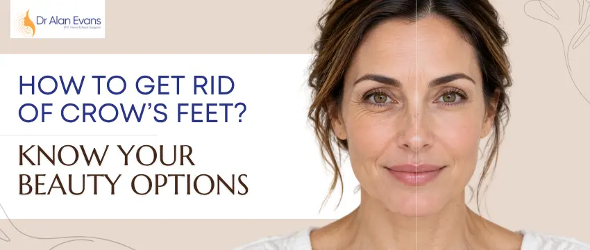 How To Get Rid Of Crow’s Feet? – Know Your Beauty Options