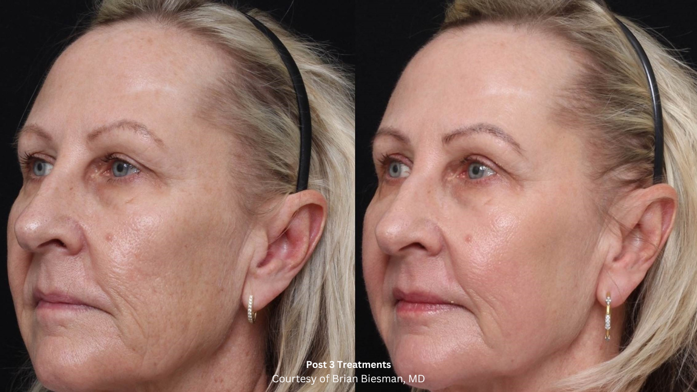 Beforeafter-6