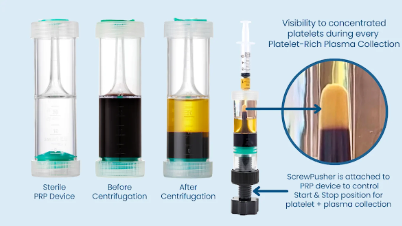 PRP facial treatment for skin rejuvenation Sydney