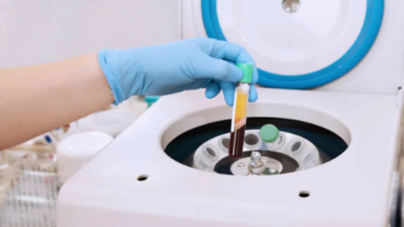 PRP therapy for skin renewal in Sydney