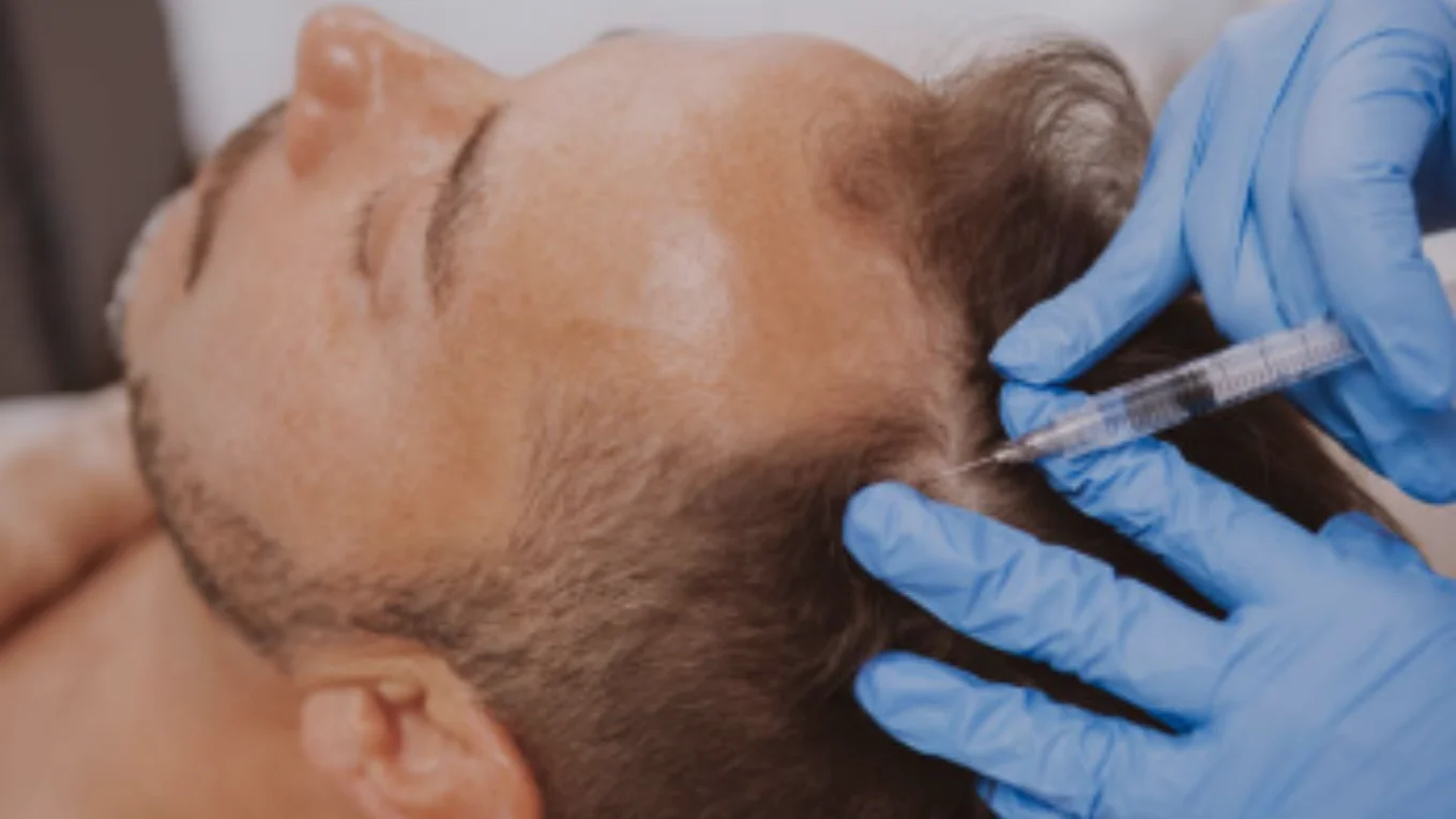 PRP treatment in Sydney clinic